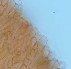 5 µm in size with basal clamp connection; context homoiomerous; gill trama regular; subhymenium pseudoparenchymatous. Stipe cuticle hyphae parallel, measuring 3.2-14.5 µm in width.