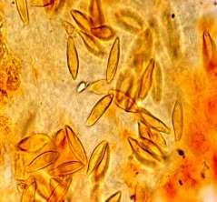 Cheilocystidia crowded, clavate to lageniform, 16.6-28.2 x 7.5-12.5 µm in size.