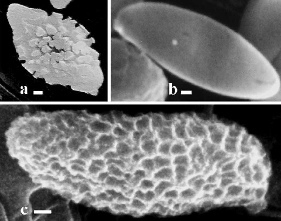 230 MYCOLOGIA FIG. 6. Scanning electron micrographs of basidiospores. a. Austroboletus rostrupii (Henkel 8189). b. Fistulinella cinereoalba (HOLOTYPE; Henkel 8471). c. Austroboletus festivus (Henkel 8164).