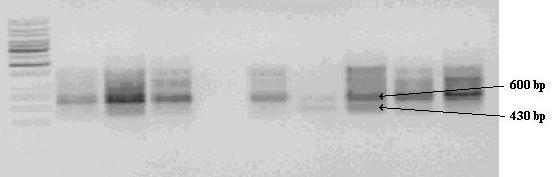 M 1 2 3 4 5 6 7 8 Fig. 1. Strawberry DNA electrophoregram, after PCR using primer OPO-16.