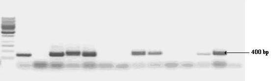 M 1 2 3 4 5 6 7 8 9 10 11 12 13 14 Fig. 2. Strawberry DNA electrophoregram, after PCR using primers RPFNF1 and RPFNR1.