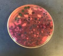 INTRODUCTION 52 Probiotic Samples were received from Bangladesh Plated in four different culture media: Agar Bacillus Differential