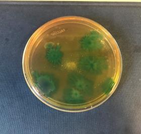 (104 bp) # Bacteria Culture