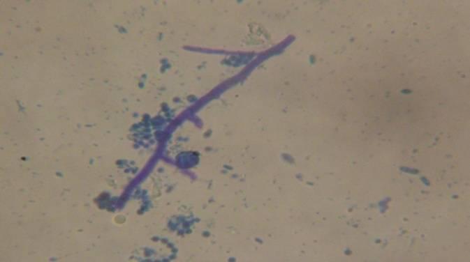 Trichoderma spp., growth (b). Plate 8c.