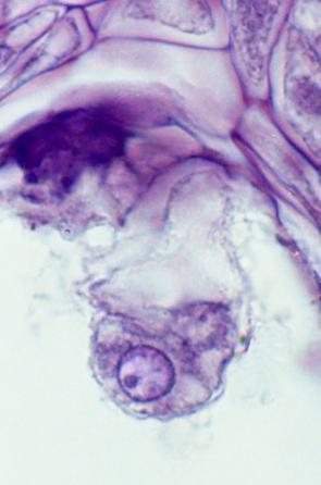 egg cell with synergids and central nucleus of embryo sac),