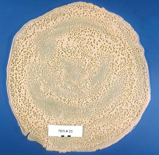 Introduction Injera is an Ethiopian fermented leavened flat bread made from various cereal flours