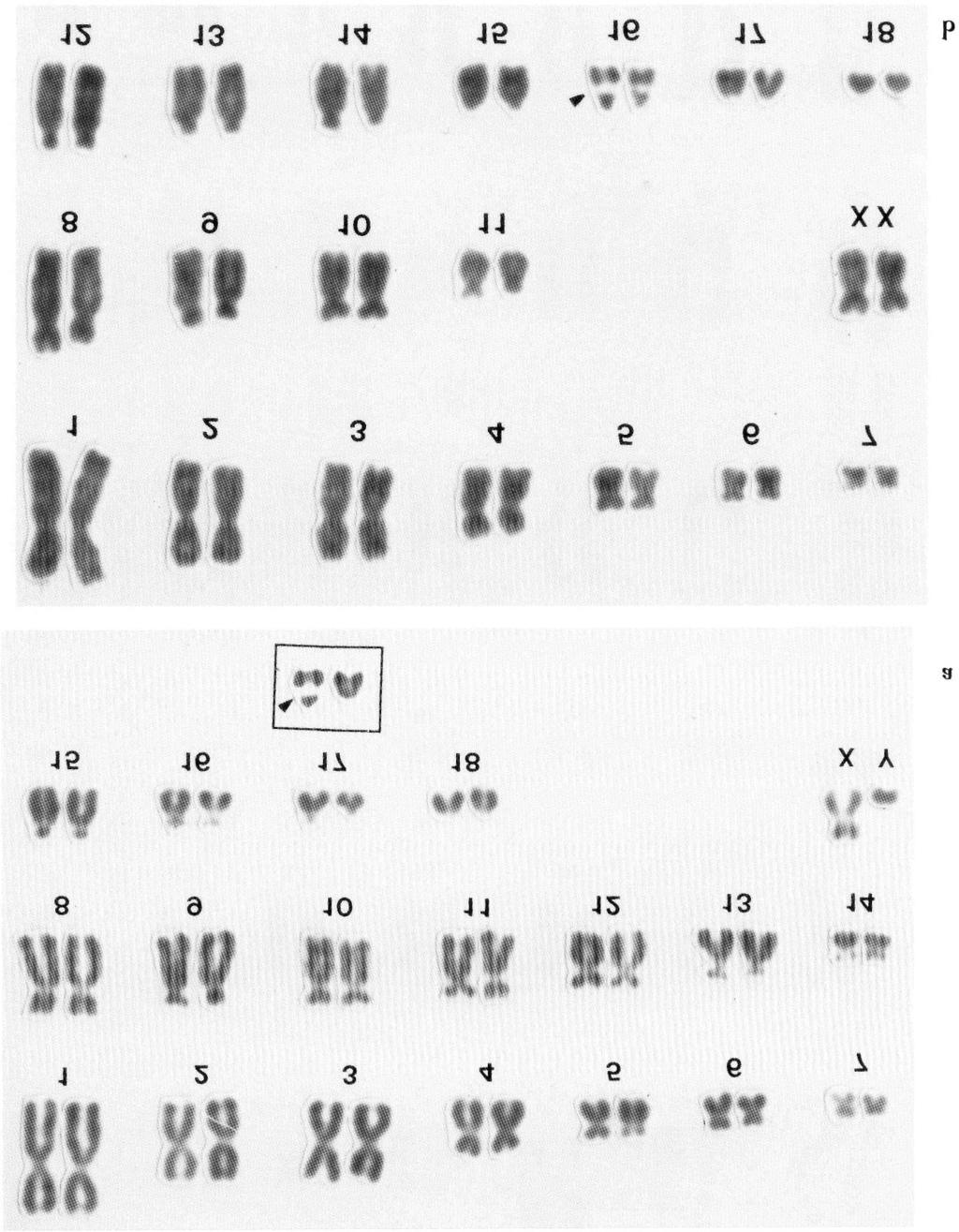 KARYOTYPES OF JAPANESE AND SIBERIAN WEASELS 271 Fig. 1 Conventional karyotypes of a male Japanese weasel Mustela itatsi (a) and a female Siberian weasel M.