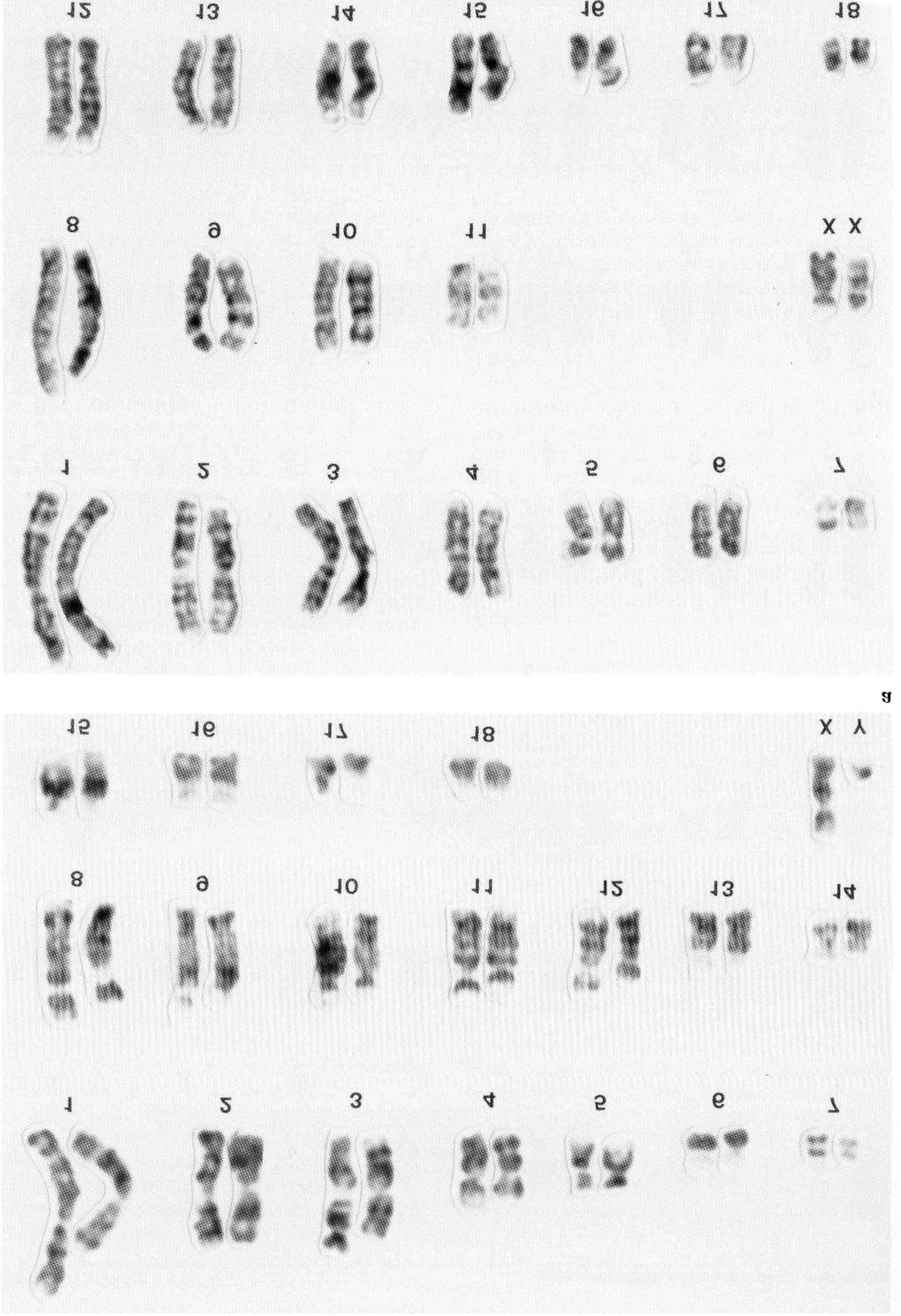 Fig. 2 G-banded karyotypes of a male