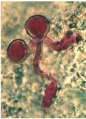 cinerea infection Infection pathways (Elmer & Michailides