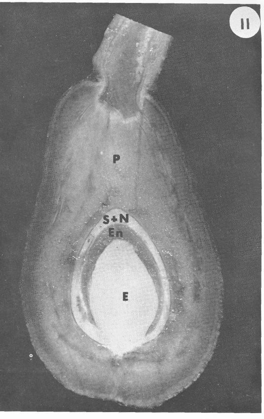 component of the seed at the end of this period (Table 1). Fig. 6. Avocado fruit tissues.
