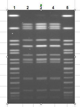 Gel ID: NM8070 Date Gel Run: 5/20/08 Outbreak Detection by PFGE Lane Age Gender Submitter Submitted Serotype Enzyme Pattern Match 2 58 Female Gallup Med