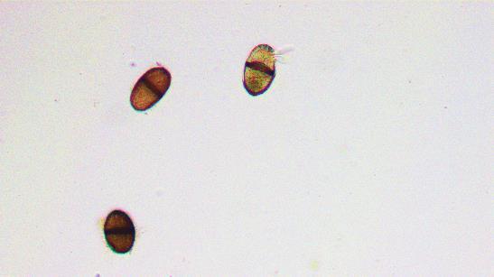 Lasiodiplodia theobromae Telemorph: Botryosphaeria rhodina