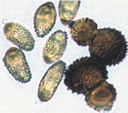 Light micrograph of urediniospores (left) and teliospores (right) of T.