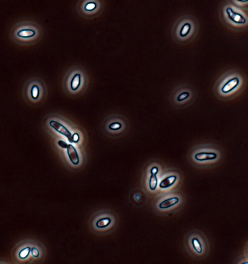 Native Yeast Brettanomyces bruxellensis Aroma defects in wine: