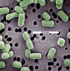 Lactobacillus species Biogenic amines histamine cadaverine putrescine tyramine Problem during sluggish/stuck ferments