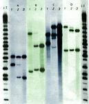 Old School DNA Fingerprinting 4 different fingerprint