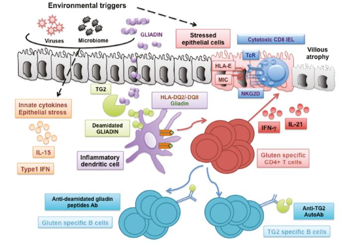 Celiac Disease The immune process Innate & Adaptive Systems