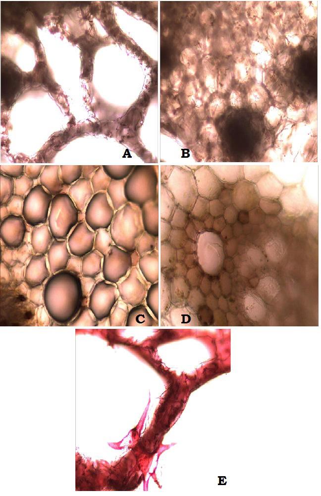 Fig. 2: -Powder Microscopy, a) General View of Powder Sample, B) Lamellar