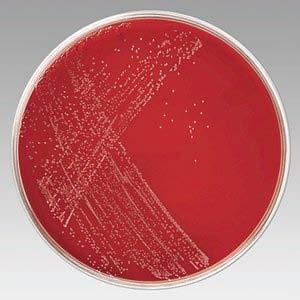 Why Culture Campylobacter Under Low Oxygen?