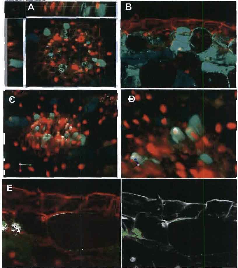 Figure 10. Localisation de l'expression de la GFP au niveau cellulaire par microscopie confocale chez des racines de C. arabica transformées par A. rhizogenes souche A4-pBin 19-p35S-GFP4.