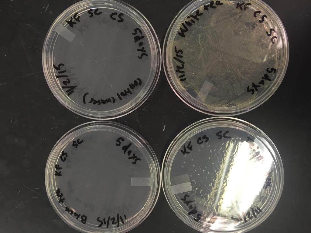 Results We observed our plates after 2 days at