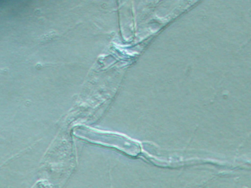 pathogen mycelium