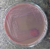 Hence they were found to be unfavorable for consumption The presence of coliforms in fruit juice sample may be due to poor personal and domestic hygiene