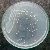 of E. coli Plate 10: E.