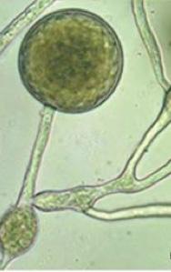 A: thread-like mycelia and lemon-shaped sporangia containing zoospores; B: swollen mycelia and chlamydospores 22 to 39 μm in diameter; and C: oospores 22 to 35 μm in diameter (oospore image courtesy