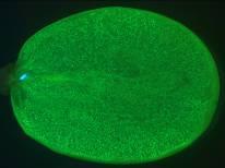 Fluorescein diacetate (FDA) staining &