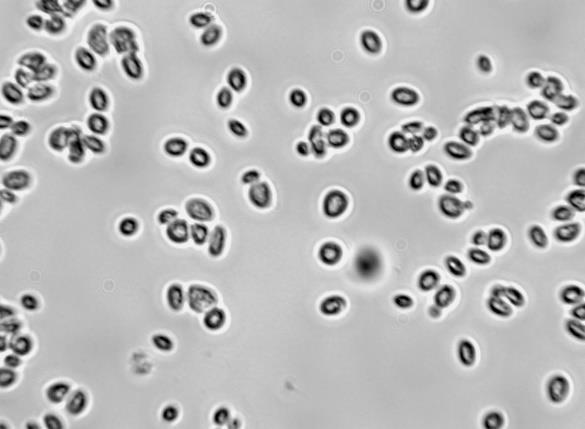 Genus/species (aliases): Saccharomyces cerevisiae (Candida robusta,
