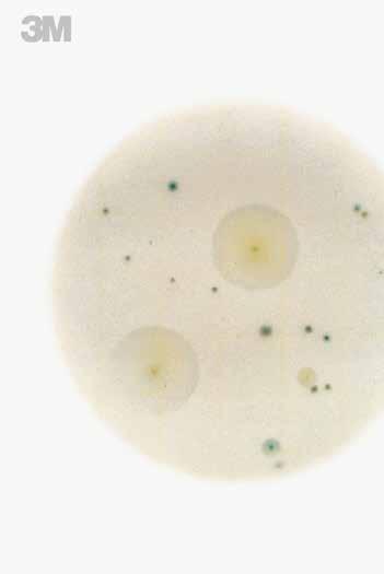 Interpretation Guide The 3M Petrifilm Yeast and Mold Count Plate is a sample-ready culture medium system which contains nutrients supplemented with antibiotics, a cold-water-soluble gelling agent,