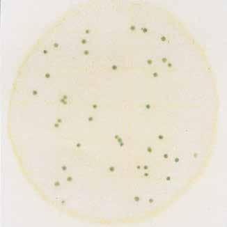 Macroscopic Differentiation Figure 7 Figure 8 Yeast count = 43 Figure 9 shows typical yeast colonies.