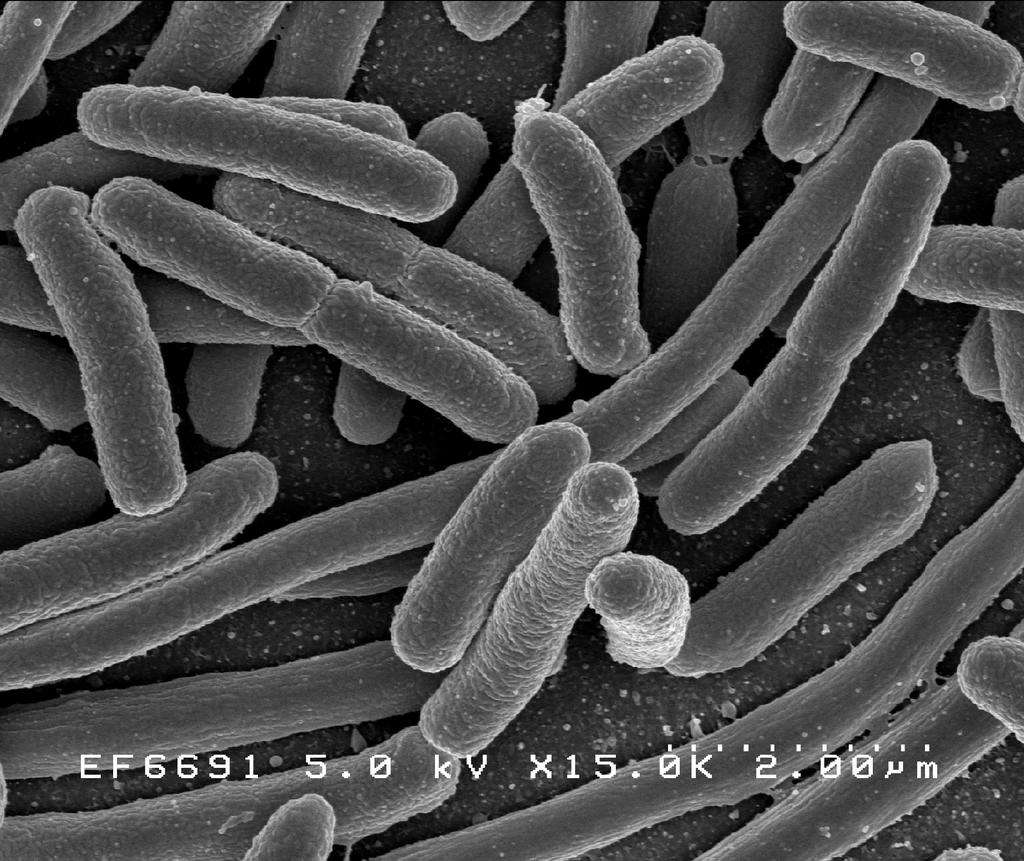 Escherichia coli Escherichia coli is a large and diverse