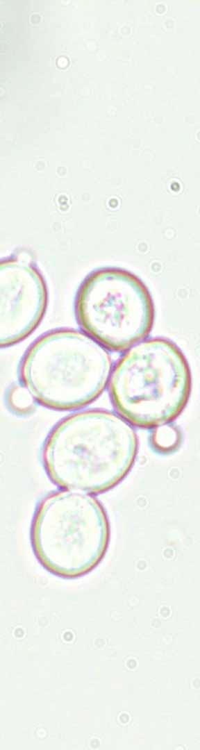 Yeast Strains: Saccharomyces cerevisiae