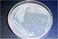 Cucurbits -Bacterial