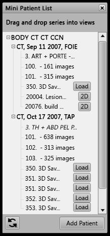 Sử dụng Tải Động Dynamic Load (Tải Động) la tính năng cho phép tải các sê-ri ảnh bổ sung đang hoạt động va o Volume Viewer.