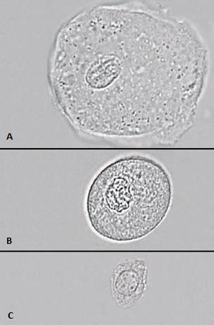 Slika 4. A)Stanica vanjskih dijelova genitalnih organa, B) stanica epitela odvodnih mokraćnih putova i C) stanica bubrežnog epitela, povećanje 400 puta, www.uoitclinicalbiochemistry.weebly.