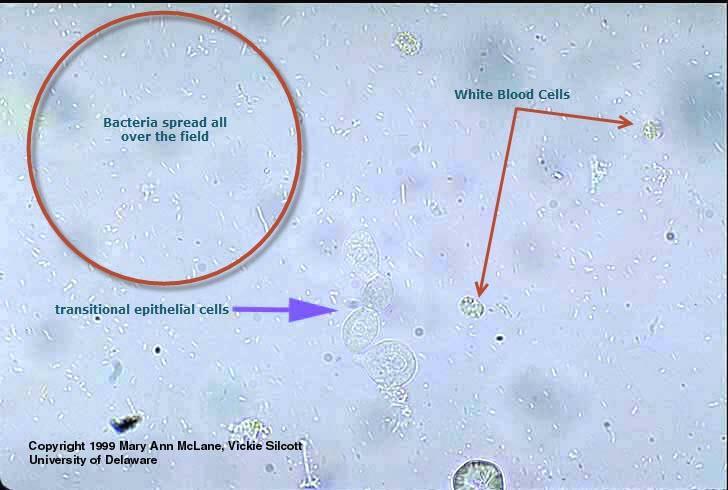 Slika 5. Bakterije u urinu, leukocit i stanice epitela odvodnih mokraćnih putova, povećanje 400 puta, McLane i Silcott, 1999. Slika 6. Pseudohife i pupanje gljivica, povećanje 400 puta, www.quizlet.
