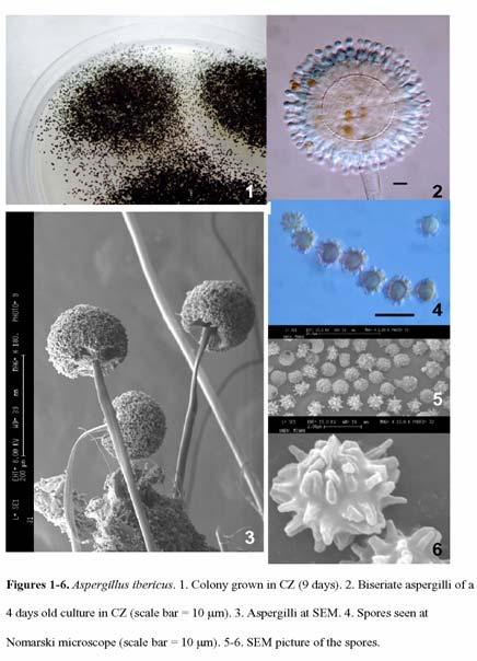 A. ibericus: a new species from grapes As part of a study on the ochratoxin producing mycoflora of grapes, six Aspergillus strains of the section Nigri which did not produce detectable amounts of OTA