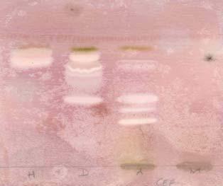 microplate dilution. Investigation of activity against C.