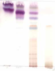 4. TLC chromatograms of serially extracted C.