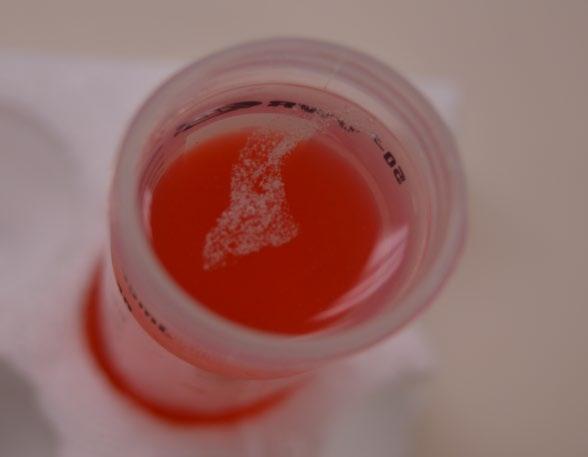 In this experiment you can extract the DNA from a strawberry using a few common household chemicals.